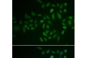Immunofluorescence analysis of U2OS cells using MYLK3 Polyclonal Antibody (MYLK3 抗体)