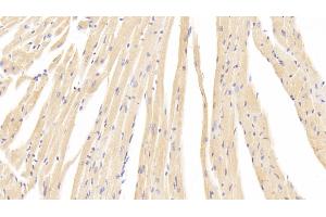 Immunohistochemistry (IHC) image for anti-Calcium Channel, Voltage-Dependent, L Type, alpha 1C Subunit (CACNA1C) (AA 1978-2139) antibody (ABIN7441256)
