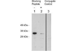 Image no. 1 for anti-Four and A Half LIM Domains 2 (FHL2) antibody (ABIN265171) (FHL2 抗体)