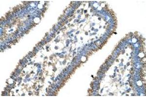 Immunohistochemical staining (Formalin-fixed paraffin-embedded sections) of human intestine with CPS1 polyclonal antibody  at 4-8 ug/mL working concentration. (CPS1 抗体  (N-Term))