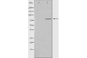 Western blot analysis of extracts from Jurkat cells, using PJA2 antibody. (PJA2 抗体)