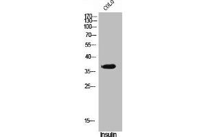 Western Blot analysis of COLO cells using Phospho-VDR (S51) Polyclonal Antibody (Vitamin D Receptor 抗体  (pSer51))