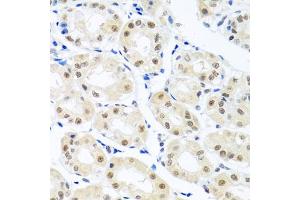 Immunohistochemistry of paraffin-embedded human stomach using THOC1 antibody (ABIN5974800) at dilution of 1/100 (40x lens). (THOC1 抗体)