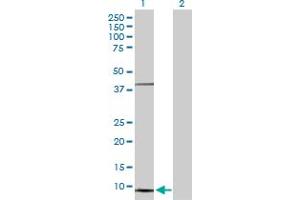 Western Blot analysis of NDUFS5 expression in transfected 293T cell line by NDUFS5 MaxPab polyclonal antibody.