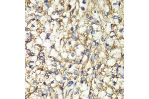 Immunohistochemistry (Paraffin-embedded Sections) (IHC (p)) image for anti-Prostaglandin E Synthase 2 (PTGES2) (AA 88-377) antibody (ABIN6146404)