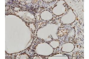 Immunoperoxidase of monoclonal antibody to SFPQ on formalin-fixed paraffin-embedded human thyroid nodular goiter. (SFPQ 抗体  (AA 269-361))