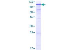 TLE1 Protein (AA 1-770) (GST tag)