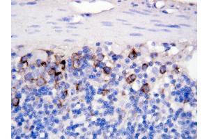 Anti CD40Lantibody,  IHC(P) IHC(P): Rat Intestine Tissue (CD40 Ligand 抗体  (N-Term))