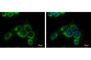 ICC/IF Image RRM1 antibody detects RRM1 protein at cytoplasm by immunofluorescent analysis.