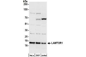 Western Blotting (WB) image for anti-Late Endosomal/lysosomal Adaptor, MAPK and mTOR Activator 1 (LAMTOR1) (AA 111-161) antibody (ABIN7452946)