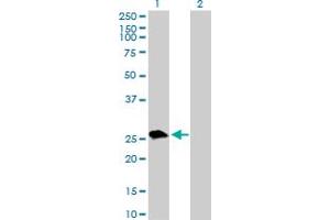 Western Blot analysis of UROS expression in transfected 293T cell line by UROS MaxPab polyclonal antibody. (UROS 抗体  (AA 1-265))