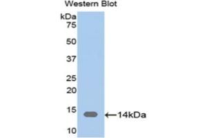 Detection of Recombinant CAP1, Human using Polyclonal Antibody to Adenylyl Cyclase Associated Protein 1 (CAP1) (CAP1 抗体  (AA 38-149))