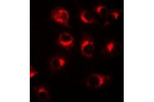 Immunofluorescent analysis of BCL10 staining in A549 cells. (BCL10 抗体)