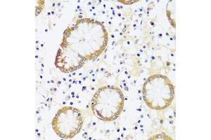 Immunohistochemistry of paraffin-embedded human stomach using CaMKI antibody (ABIN7266017) at dilution of 1:100 (40x lens). (CAMK1 抗体  (AA 1-93))