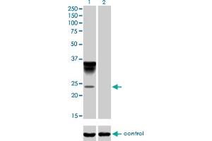 Western blot analysis of ORM1 over-expressed 293 cell line, cotransfected with ORM1 Validated Chimera RNAi (Lane 2) or non-transfected control (Lane 1). (ORM1 抗体  (AA 18-201))