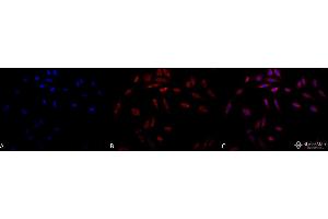 Immunocytochemistry/Immunofluorescence analysis using Mouse Anti-Hsp47 Monoclonal Antibody, Clone 1C4-1A6 . (SERPINH1 抗体  (FITC))
