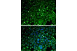 Immunofluorescence analysis of HeLa cells using CRYAA antibody (ABIN5973354). (CRYAA 抗体)