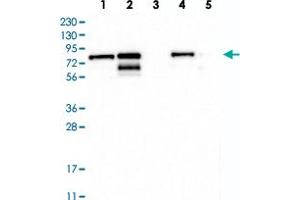 Western blot analysis of Lane 1: RT-4, Lane 2: U-251 MG, Lane 3: Human Plasma, Lane 4: Liver, Lane 5: Tonsil with TMTC2 polyclonal antibody  at 1:250-1:500 dilution. (TMTC2 抗体)