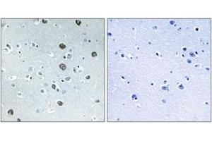Immunohistochemistry analysis of paraffin-embedded human brain tissue, using MARCH2 Antibody.