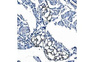 IHC analysis of eRF1/ETF1 using anti-eRF1/ETF1 antibody (ABIN7602626).