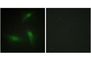 Immunofluorescence analysis of HeLa cells, using hnRNP A1 Antibody. (HNRNPA1 抗体  (AA 51-100))