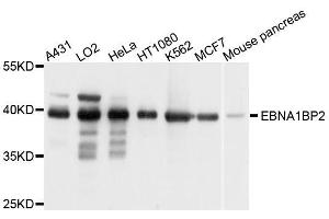 Western blot analysis of extracts of various cell lines, using EBNA1BP2 antibody. (EBNA1BP2 抗体  (AA 1-306))