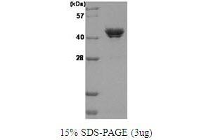 CSNK2A1/CK II alpha Protein (AA 1-391) (His tag)