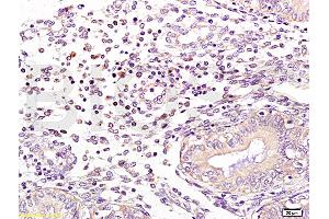 Formalin-fixed and human endometrium tissue labeled with Anti-NCF1/p47 phox Polyclonal Antibody, Unconjugated (ABIN750643) at 1:100 followed by conjugation to the secondary antibody and DAB staining (NCF1 抗体  (AA 151-250))