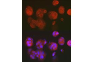 Immunofluorescence analysis of MCF7 cells using DNPH1 Rabbit mAb (ABIN7266383) at dilution of 1:50 (40x lens). (RCL 抗体)