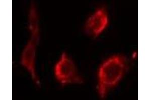ABIN6275545 staining HeLa cells by IF/ICC. (PPP2R2B 抗体  (Internal Region))