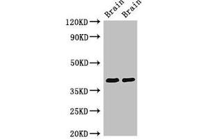 Western Blot Positive WB detected in: Rat brain tissue, Mouse brain tissue All lanes: STOML3 antibody at 3. (STOML3 抗体  (AA 205-291))