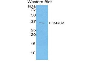 Western Blotting (WB) image for anti-Interferon Regulatory Factor 4 (IRF4) (AA 175-433) antibody (ABIN3206122) (IRF4 抗体  (AA 175-433))