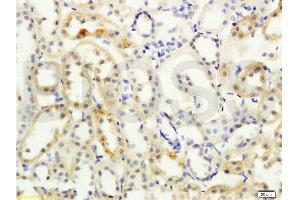 Formalin-fixed and paraffin embedded rat kidney labeled with Anti- NCX2/SLC8A2 Polyclonal Antibody, Unconjugated  at 1:200 followed by conjugation to the secondary antibody and DAB staining (SLC8A2 抗体  (AA 601-700))