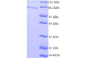 SDS-PAGE (SDS) image for Zinc Finger and SCAN Domain Containing 20 (ZSCAN20) (AA 1-433), (Isoform 4) protein (His-SUMO Tag) (ABIN5710658) (ZSCAN20 Protein (AA 1-433, Isoform 4) (His-SUMO Tag))