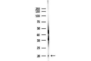 anti-Receptor Accessory Protein 1 (REEP1) (C-Term) antibody