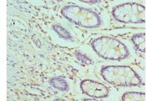 Immunohistochemistry of paraffin-embedded human colon tissue using ABIN7144372 at dilution of 1:100 (AP2M1 抗体  (AA 136-435))