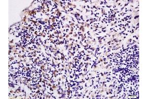 Formalin-fixed and paraffin embedded rat spleen labeled with Rabbit Anti-LPA2 Polyclonal Antibody, Unconjugated (ABIN2177376) at 1:200 followed by conjugation to the secondary antibody and DAB staining (EDG4 抗体  (AA 1-100))
