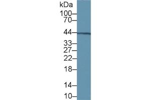 Detection of vWA1 in Rat Kidney lysate using Polyclonal Antibody to Von Willebrand Factor A Domain Containing Protein 1 (vWA1) (VWA1 抗体  (AA 43-285))