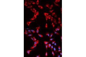 Immunofluorescence analysis of U2OS cells using EIF4B antibody. (EIF4B 抗体)