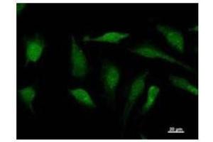 Immunostaining analysis in HeLa cells. (SOX12 抗体)