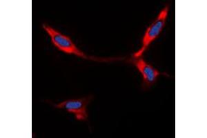 Immunofluorescent analysis of BMP8A staining in A549 cells. (BMP8A 抗体  (C-Term))