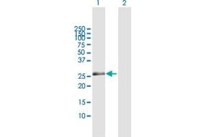 Western Blot analysis of ZNF266 expression in transfected 293T cell line by ZNF266 MaxPab polyclonal antibody. (ZNF266 抗体  (AA 1-263))
