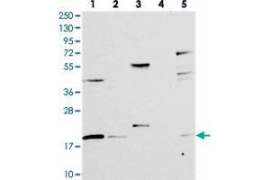 Western blot analysis of Lane 1: RT-4, Lane 2: U-251 MG, Lane 3: Human Plasma, Lane 4: Liver, Lane 5: Tonsil with RMI2 polyclonal antibody  at 1:250-1:500 dilution. (RMI2 抗体)