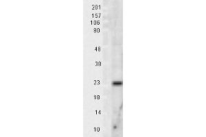 Mn SOD Rat tissue lysate 10ug Western Blotting 1 in 1000 copy. (SOD2 抗体)