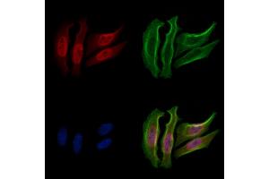 ABIN6255132 and ABIN6267338 staining Hela cells(20 min of 30uM Forskolin treatment) by IF/ICC.