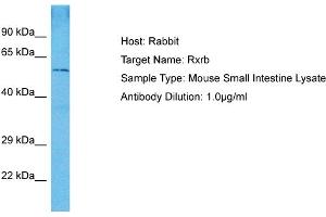 Host: Mouse Target Name: RXRB Sample Tissue: Mouse Small Intestine Antibody Dilution: 1ug/ml (Retinoid X Receptor beta 抗体  (N-Term))