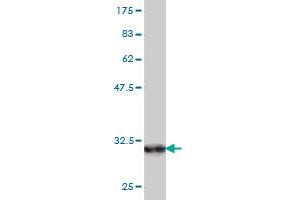 Western Blotting (WB) image for anti-Osteocalcin (BGLAP) (AA 52-100) antibody (ABIN560055)