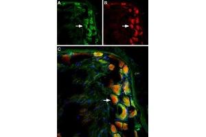 Immunohistochemistry (IHC) image for anti-Transient Receptor Potential Cation Channel, Subfamily V, Member 2 (TRPV2) (AA 413-428), (Extracellular) antibody (ABIN7043843)