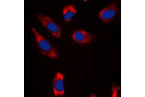 Immunofluorescent analysis of STMN1 staining in HeLa cells. (Stathmin 1 抗体  (N-Term))