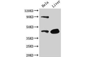 Western Blot Positive WB detected in: Hela whole cell lysate, Mouse liver tissue All lanes: CD46 antibody at 3 μg/mL Secondary Goat polyclonal to rabbit IgG at 1/50000 dilution Predicted band size: 44, 45, 43, 41, 42, 40, 37 kDa Observed band size: 44 kDa